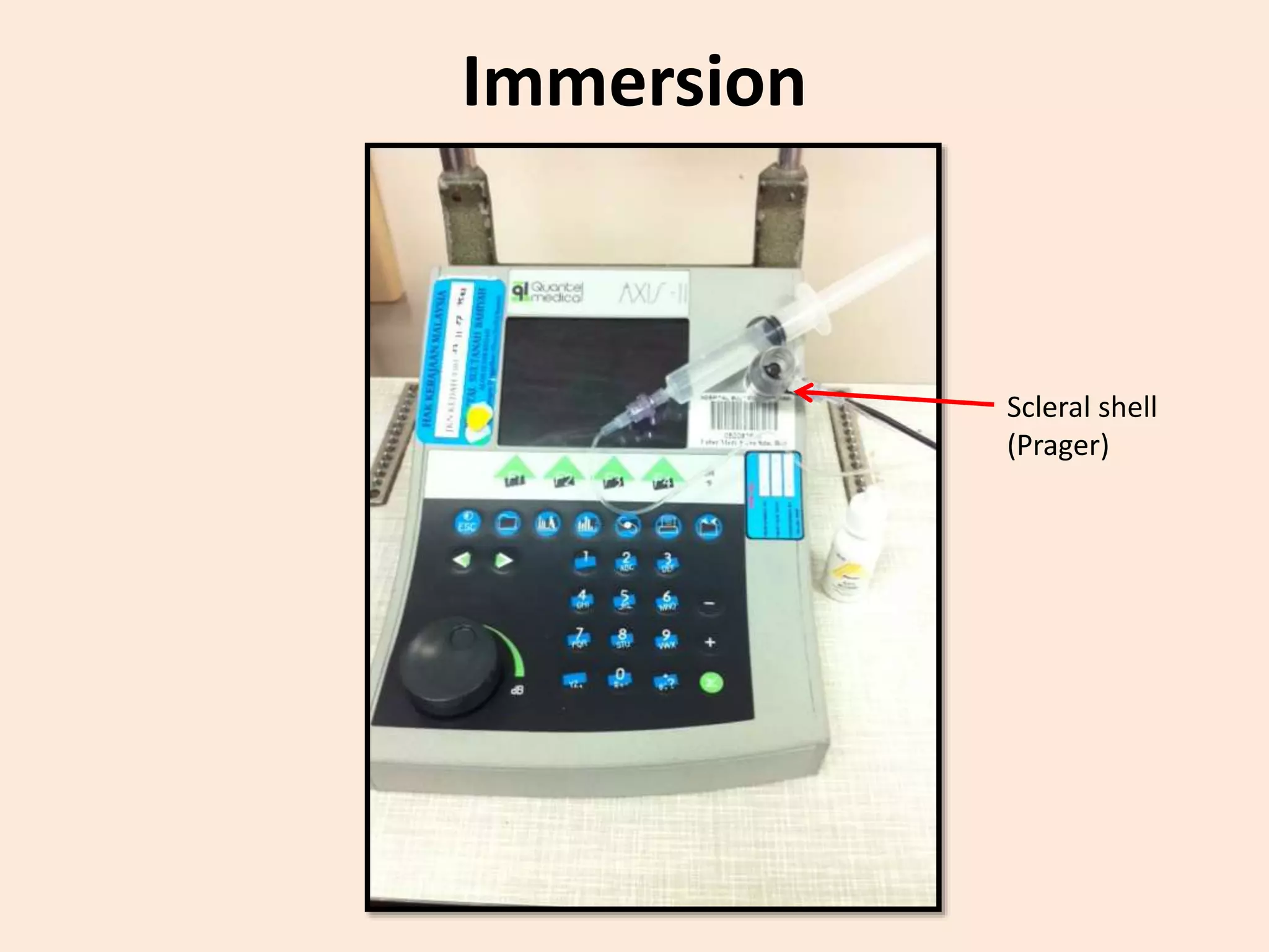 Immersion
Scleral shell
(Prager)
 