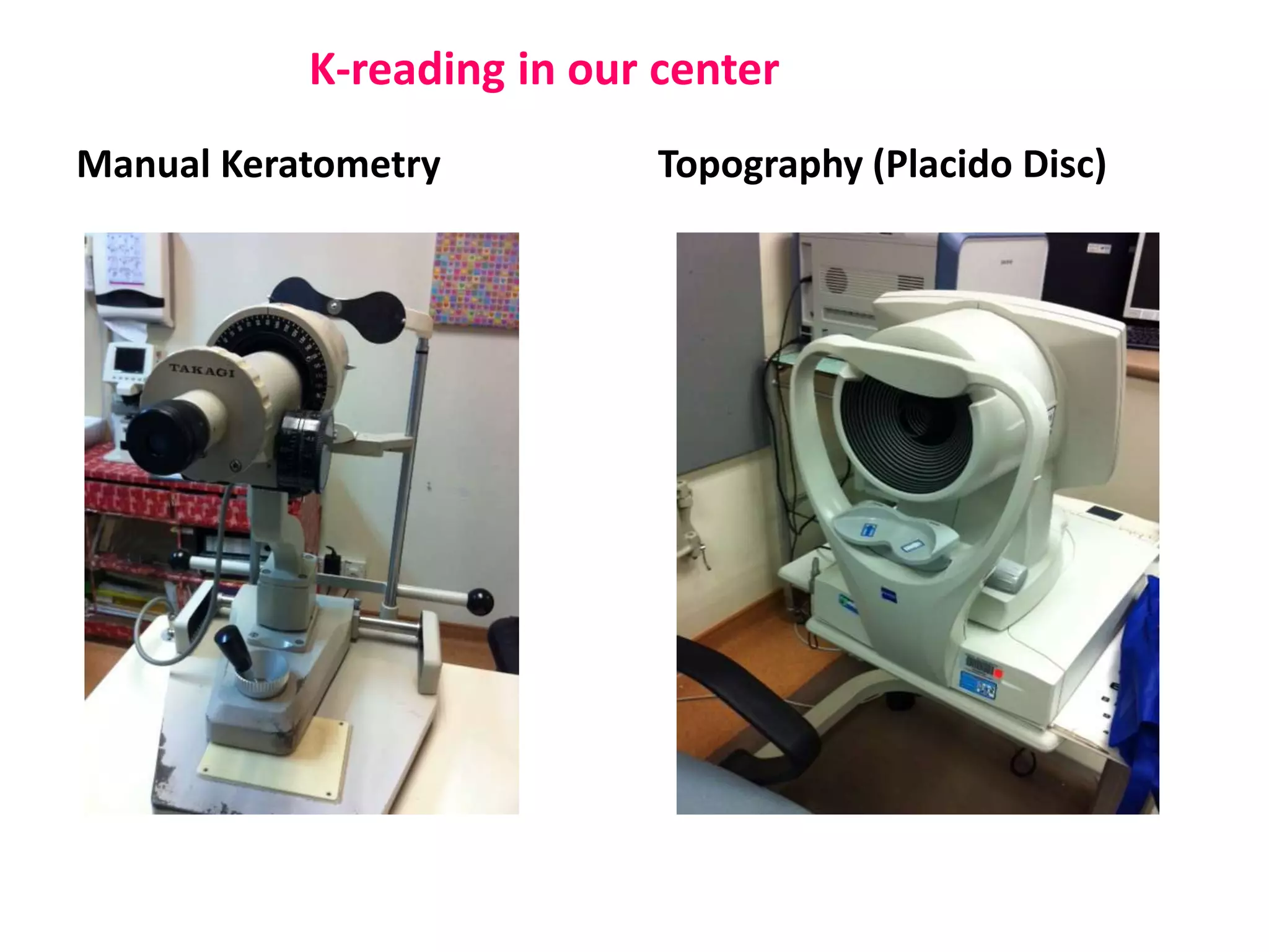 Manual Keratometry Topography (Placido Disc)
K-reading in our center
 