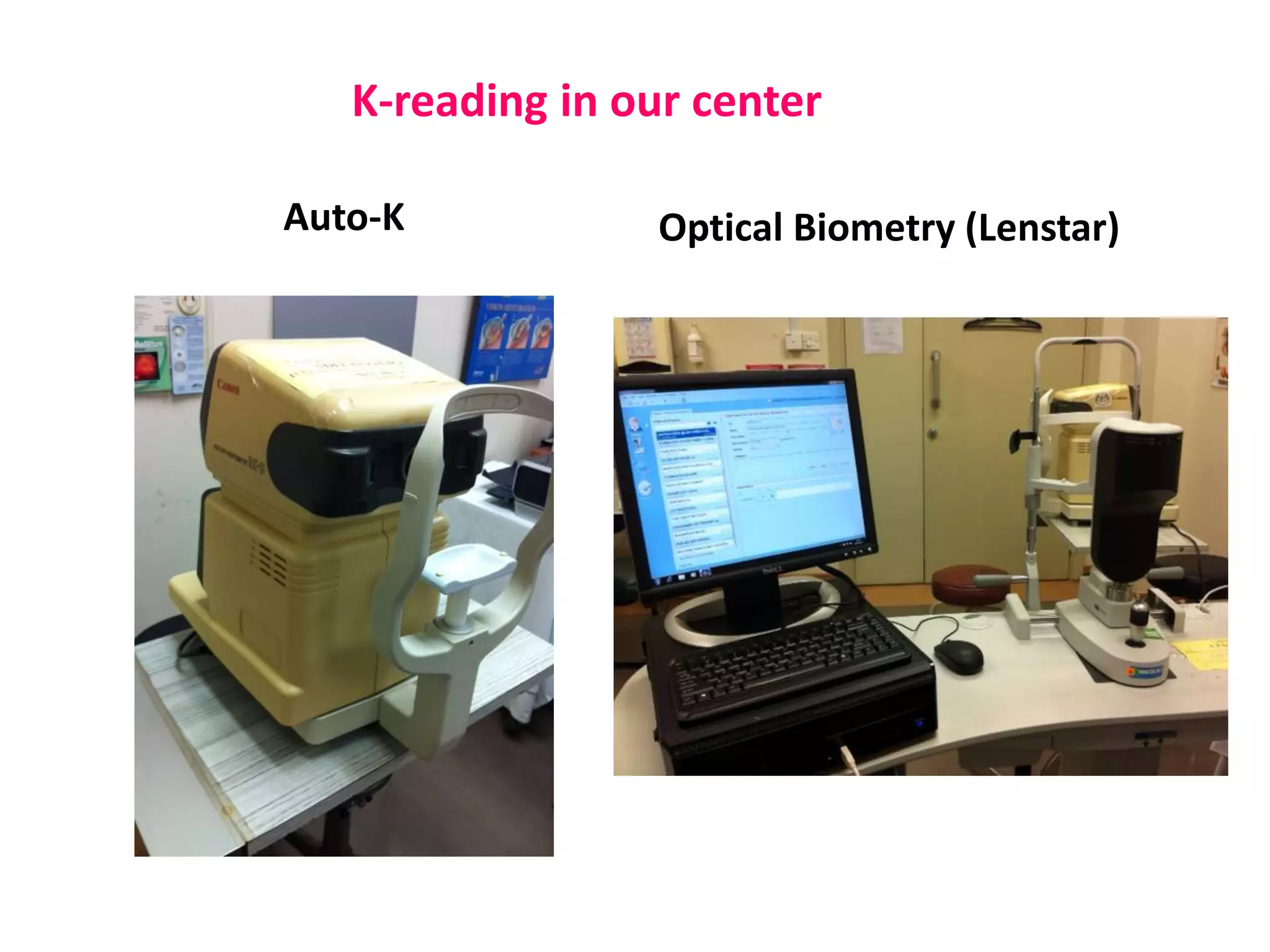 Auto-K Optical Biometry (Lenstar)
K-reading in our center
 
