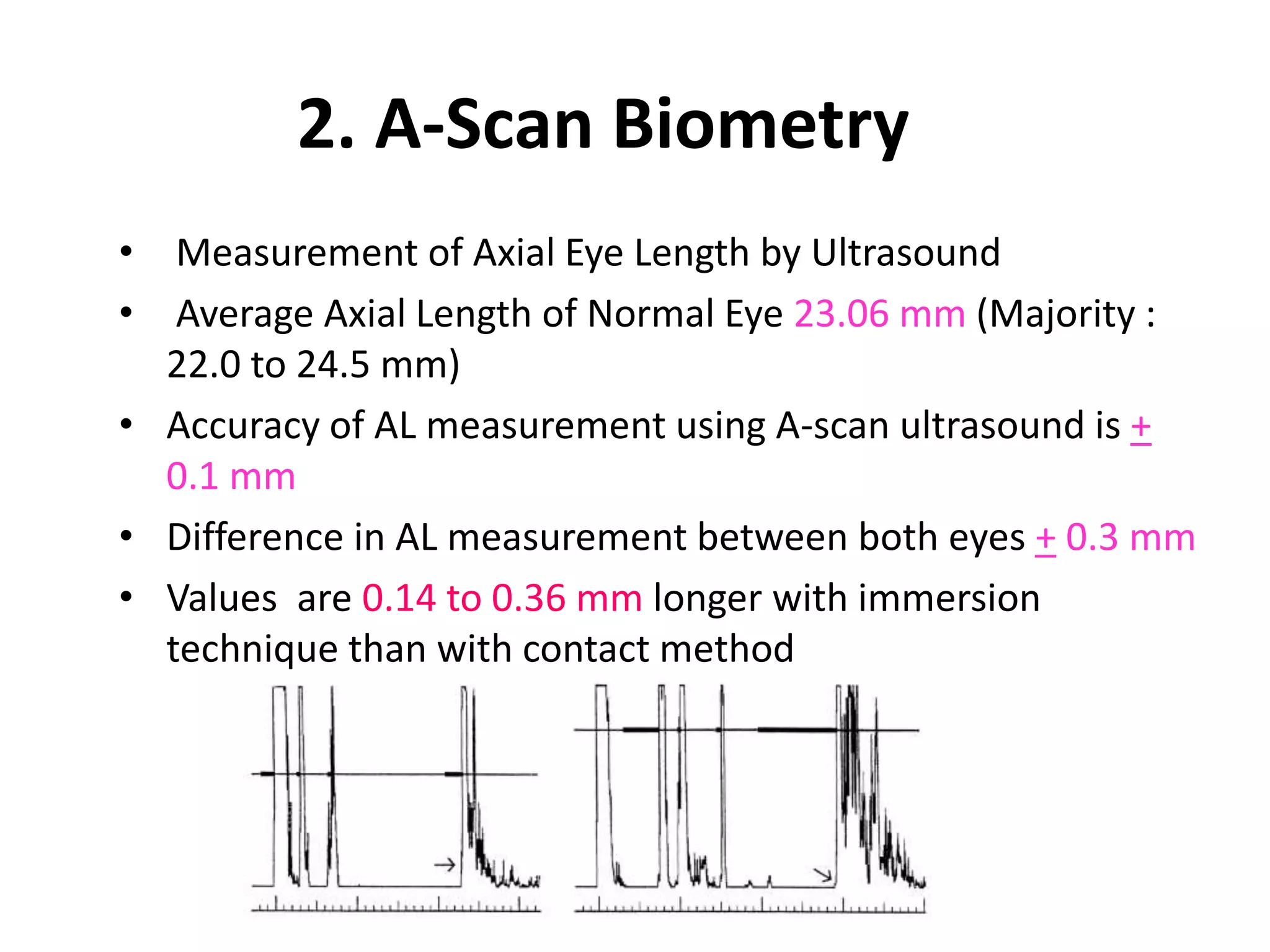 2. A-Scan Biometry
• Measurement of Axial Eye Length by Ultrasound
• Average Axial Length of Normal Eye 23.06 mm (Majority :
22.0 to 24.5 mm)
• Accuracy of AL measurement using A-scan ultrasound is +
0.1 mm
• Difference in AL measurement between both eyes + 0.3 mm
• Values are 0.14 to 0.36 mm longer with immersion
technique than with contact method
 