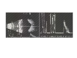 National Ocular Biometry Course (NOBC) 2015 An echoslide presentation ...