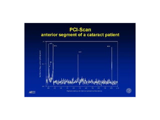 National Ocular Biometry Course (NOBC) 2015 An echoslide presentation ...