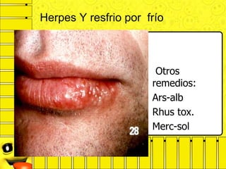Herpes Y resfrio por frío
Otros
remedios:
Ars-alb
Rhus tox.
Merc-sol
 