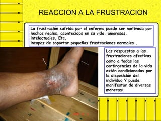 REACCION A LA FRUSTRACION
Las respuestas a las
frustraciones afectivas
como a todas las
contingencias de la vida
están condicionadas por
la disposición del
individuo Y puede
manifestar de diversas
maneras:
La frustración sufrida por el enfermo puede ser motivada por
hechos reales, acontecidos en su vida, amorosas,
intelectuales. Etc.
incapaz de soportar pequeñas frustraciones normales .
 