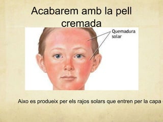 Acabarem amb la pell
cremada

Aixo es produeix per els rajos solars que entren per la capa d

 