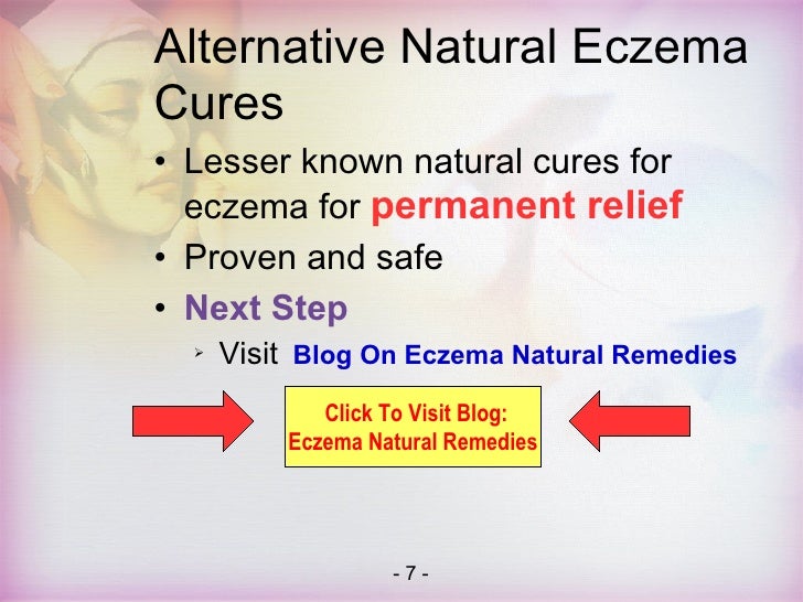 Natural Remedies For Food Allergy Rash Natural Remedies For Food Allergy Rash