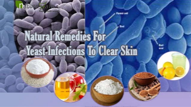 Natural Remedies For Yeast Infections In Toddlers Natural Remedies For Yeast Infections In Toddlers