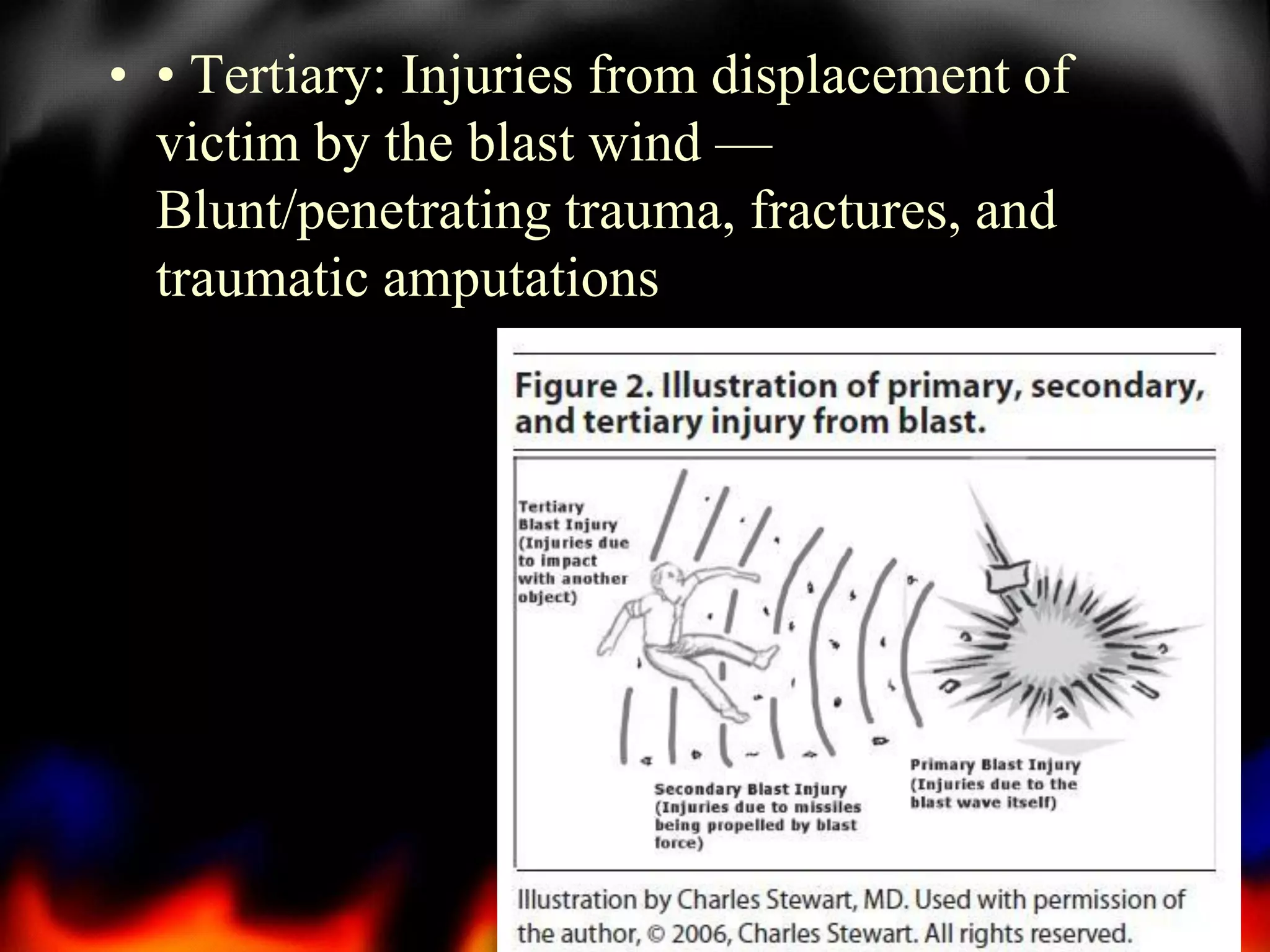 • • Tertiary: Injuries from displacement of
victim by the blast wind —
Blunt/penetrating trauma, fractures, and
traumatic amputations

16

 