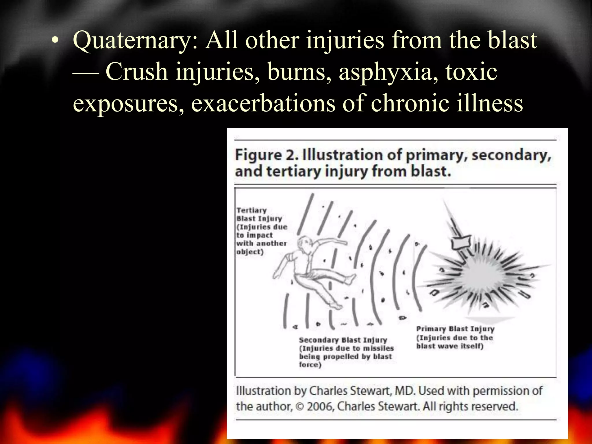 • Quaternary: All other injuries from the blast
— Crush injuries, burns, asphyxia, toxic
exposures, exacerbations of chronic illness

17

 
