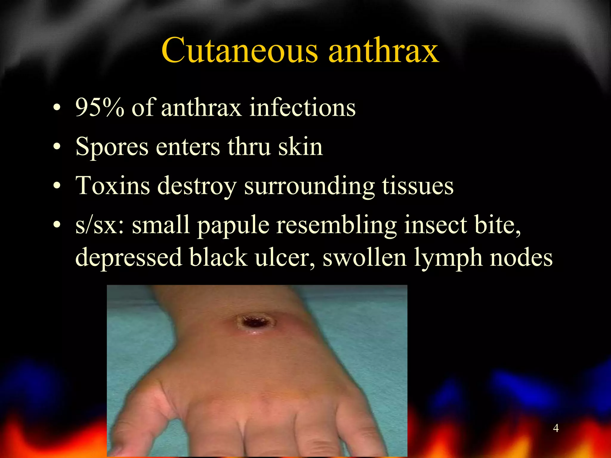 Cutaneous anthrax
•
•
•
•

95% of anthrax infections
Spores enters thru skin
Toxins destroy surrounding tissues
s/sx: small papule resembling insect bite,
depressed black ulcer, swollen lymph nodes

4

 