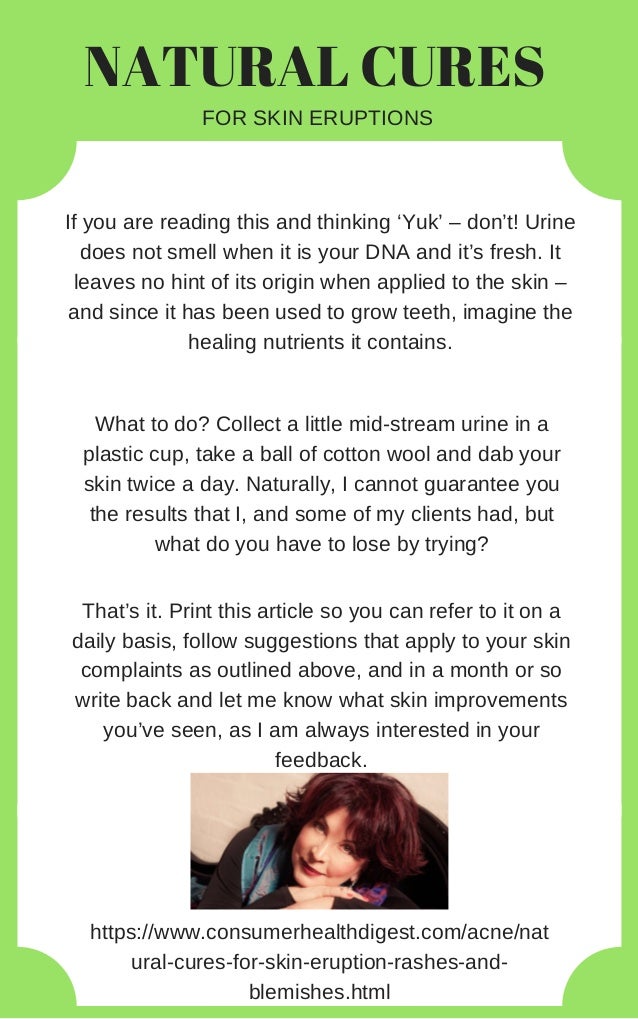 Natural Cures For Psoriasis And Eczema Natural Cures For Psoriasis And Eczema