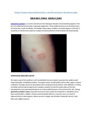 http://www.naturalherbsclinic.com/Granuloma-Annulare.php

GRANULOMA ANNULARE
Granuloma annulare is a chronic autoimmune dermatological disorder characterized by papules in the
form of reddish bumps forming a ring shape appearance. These reddish bumps are commonly present
on hands, feet, knees and elbows. This benign inflammatory condition of annular plaques on the skin is
caused by an autoimmune response causing increased production of white blood cells (leukocytosis).

GRANULOMA ANNULARE CAUSES:
The exact cause of this condition is still not identified but some doctors associate this condition with
thyroid disorders and diabetes mellitus. The patient seems overall healthy and no other organ or system
is affected. The large amount of white blood cells circulating in the blood have some difficulty in running
smoothly and thus leak through the thin capillary network to reach the undersurface of the skin,
clumping there and presenting themselves as circular reddish bumps on the surface of the skin. Among
granuloma annulare causes, association with some other autoimmune disorders is identified such as
lupus erythematosis, addison’s disease and rheumatoid arthritis. It may also occur as a result of
hypersensitivity to wheat gluten, tetanus vaccine or copper and infections along with animal, insect
bites and sunlight exposure.

 