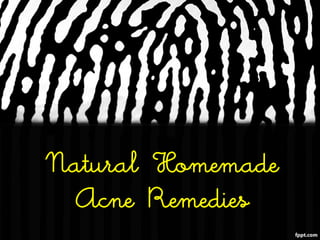Natural Homemade
 Acne Remedies
 