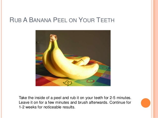 Do banana peels whiten the teeth?