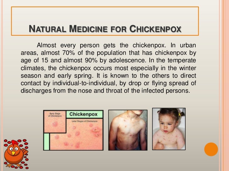 What are the symptoms of chickenpox?