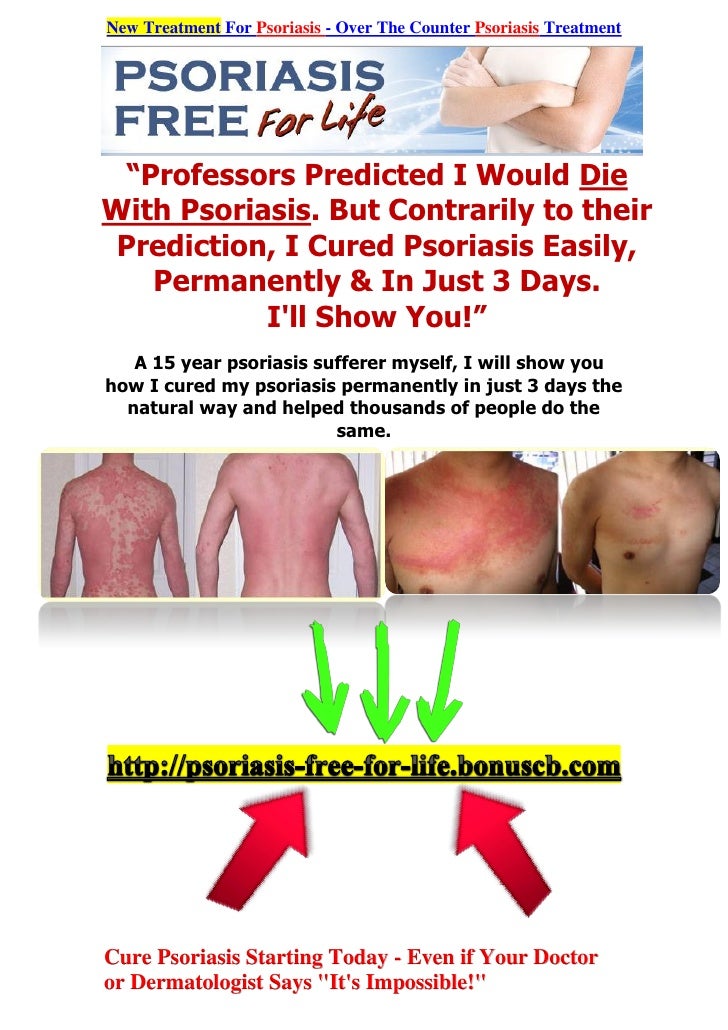 New Treatment For Psoriasis