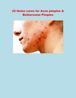 22 Home cures for Acne pimples &
Bothersome Pimples
 