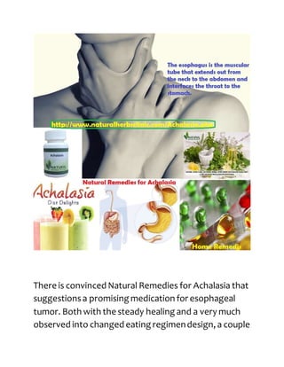 There is convinced Natural Remedies for Achalasia that
suggestionsa promising medication for esophageal
tumor. Both with the steady healing and a very much
observed into changed eating regimendesign, a couple
 