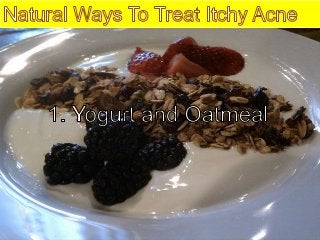 Natural Remedies for Itchy Acne on Face