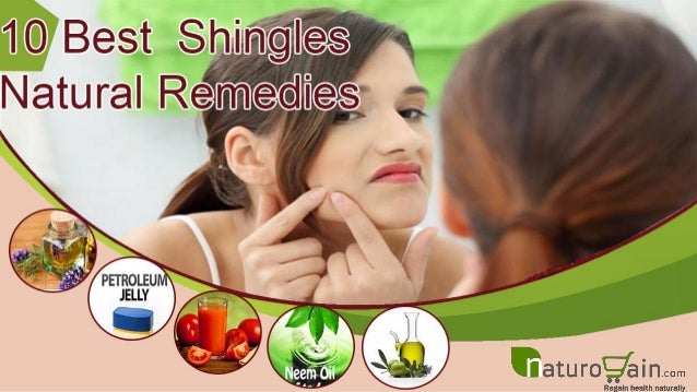 Natural Remedies For Shingles - 
