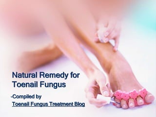 Natural Remedy for
Toenail Fungus
-Compiled by
 Toenail Fungus Treatment Blog
 