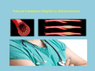Natural Substances Helpful in Atherosclerosis
 