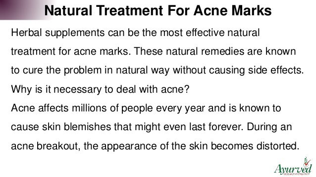 Natural Treatment For Acne Marks To Get Clear Skin In A ...