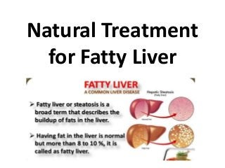 Natural Treatment
for Fatty Liver
 