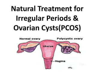 Natural Treatment for
Irregular Periods &
Ovarian Cysts(PCOS)
 