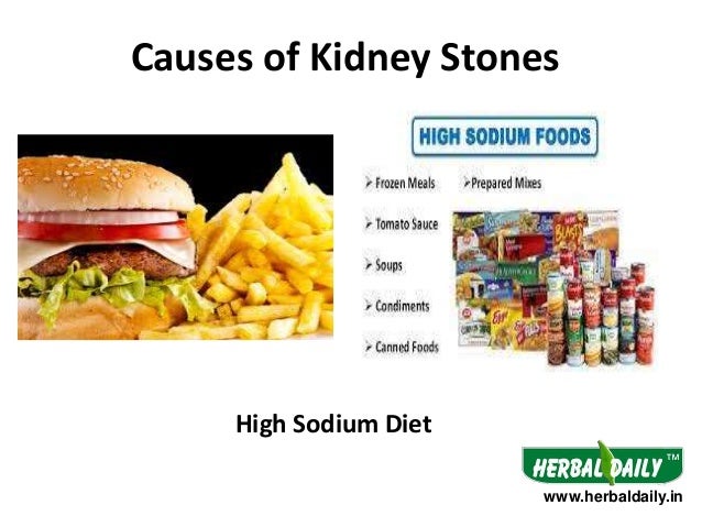 diet to prevent kidney stones 7 pounds