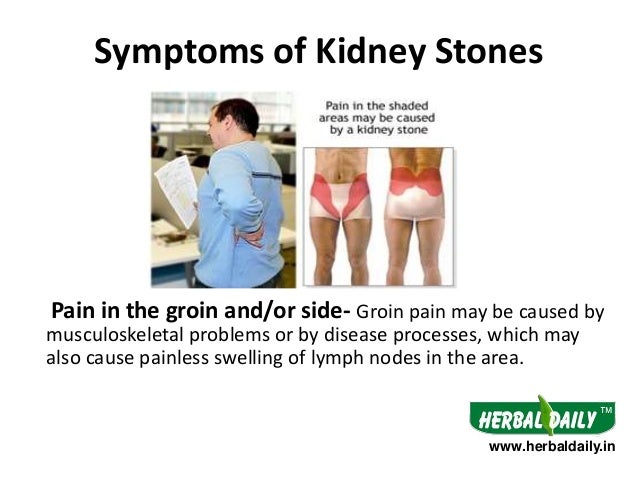 Natural Relief For Kidney Stone Pain While In Pain Natural Relief For Kidney Stone Pain While In Pain