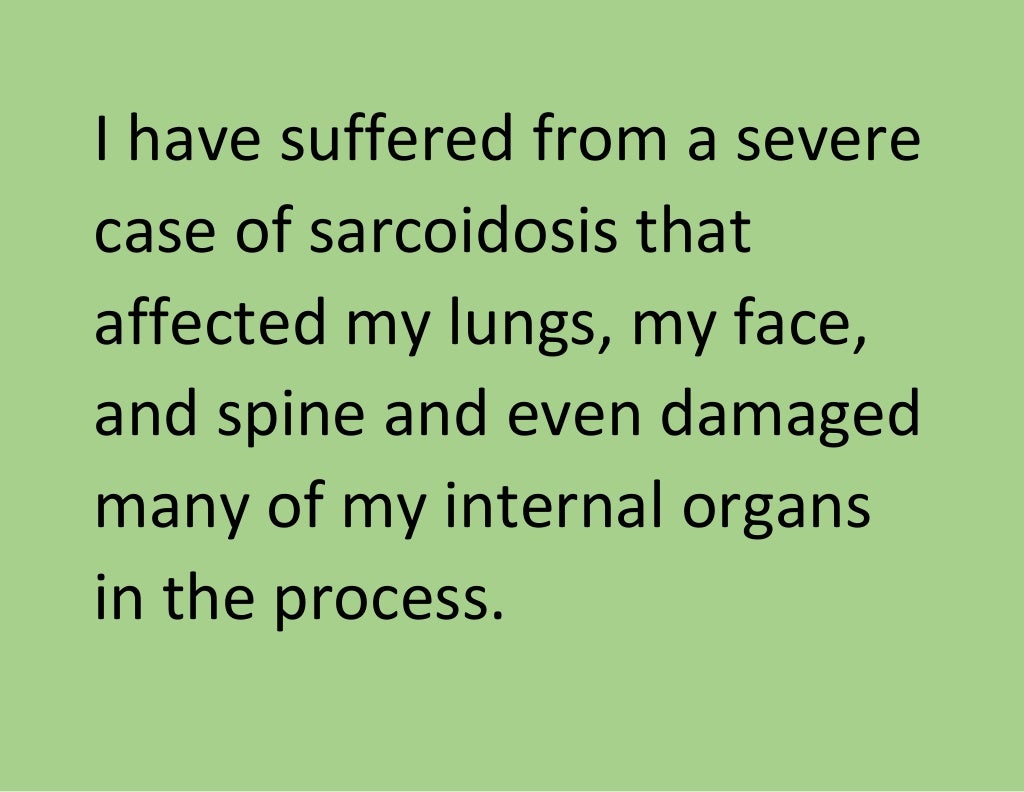 Natural Treatment For Sarcoidosis That Truly Works