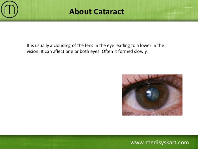 Natural Way To Remove Cataracts Natural Way To Remove Cataracts