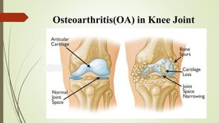 Nature of Joints & Joints Diseases ppt.pptx