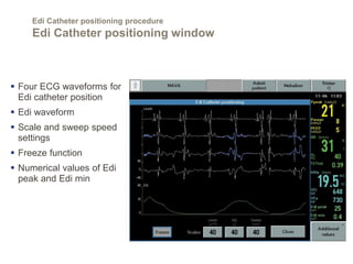 Getinge Edi Module Getinge ventilation strategy using nava ventilation | PDF