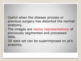  Useful when the disease process or
previous surgery has distorted the normal
anatomy.
 The images are vector representations of
previously segmented and processed
data.
 3D data set can be superimposed on pt’s
anatomy.
 