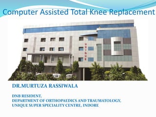Navigation Assisted Total Knee Replacement | PPTX