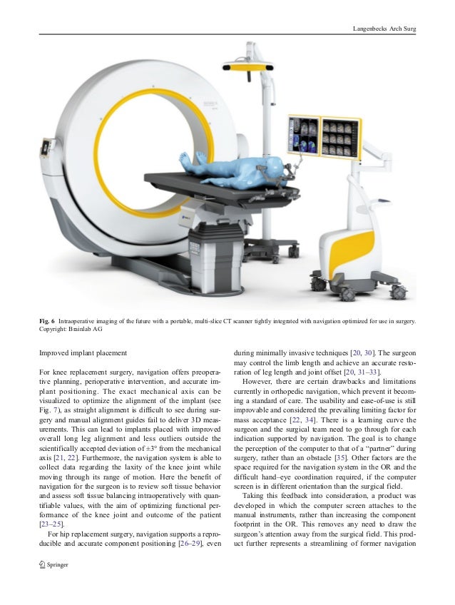 Navigation in Surgery