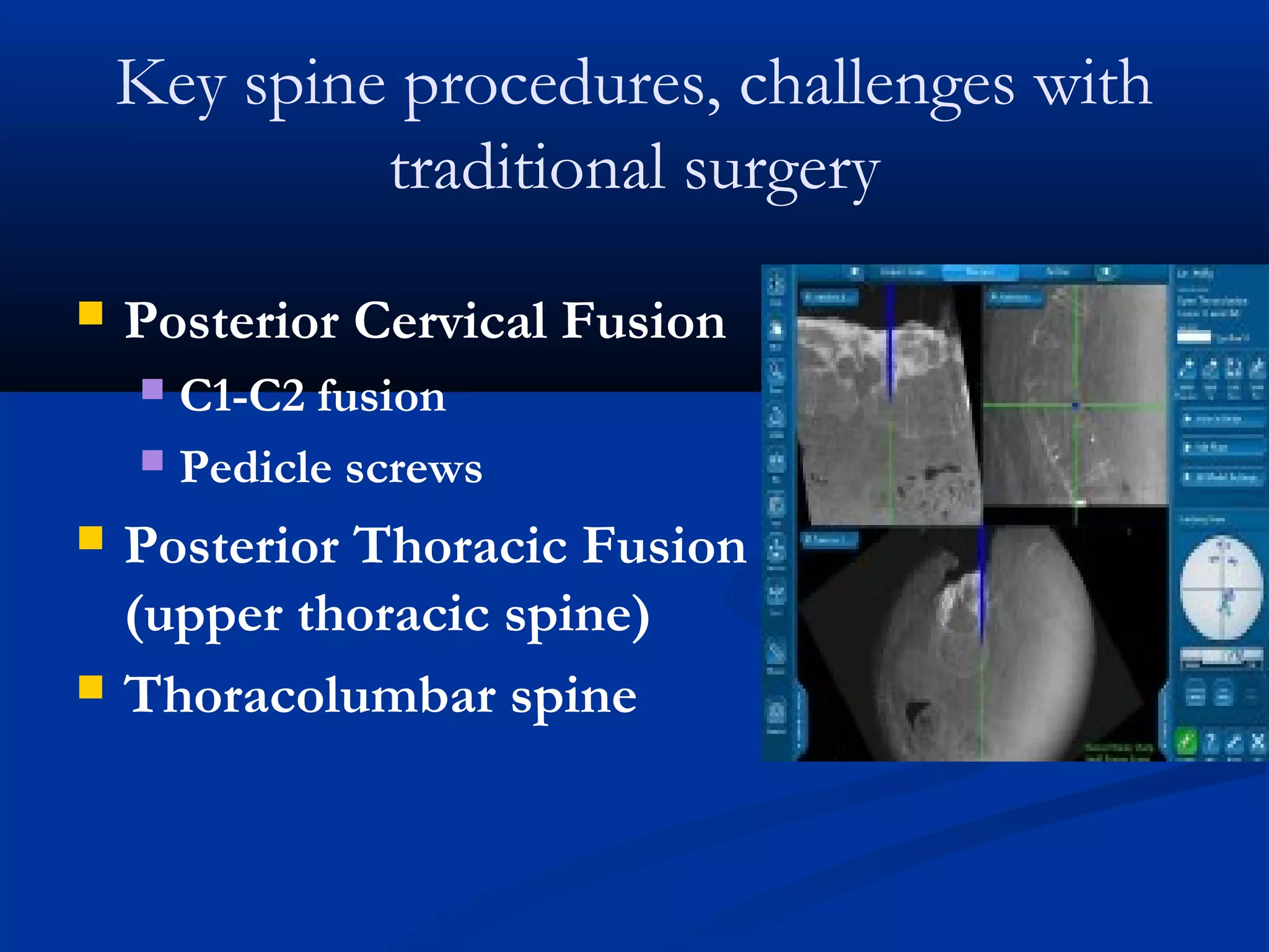 Key spine procedures, challenges with
traditional surgery
 Posterior Cervical Fusion
 C1-C2 fusion
 Pedicle screws
 Posterior Thoracic Fusion
(upper thoracic spine)
 Thoracolumbar spine
 