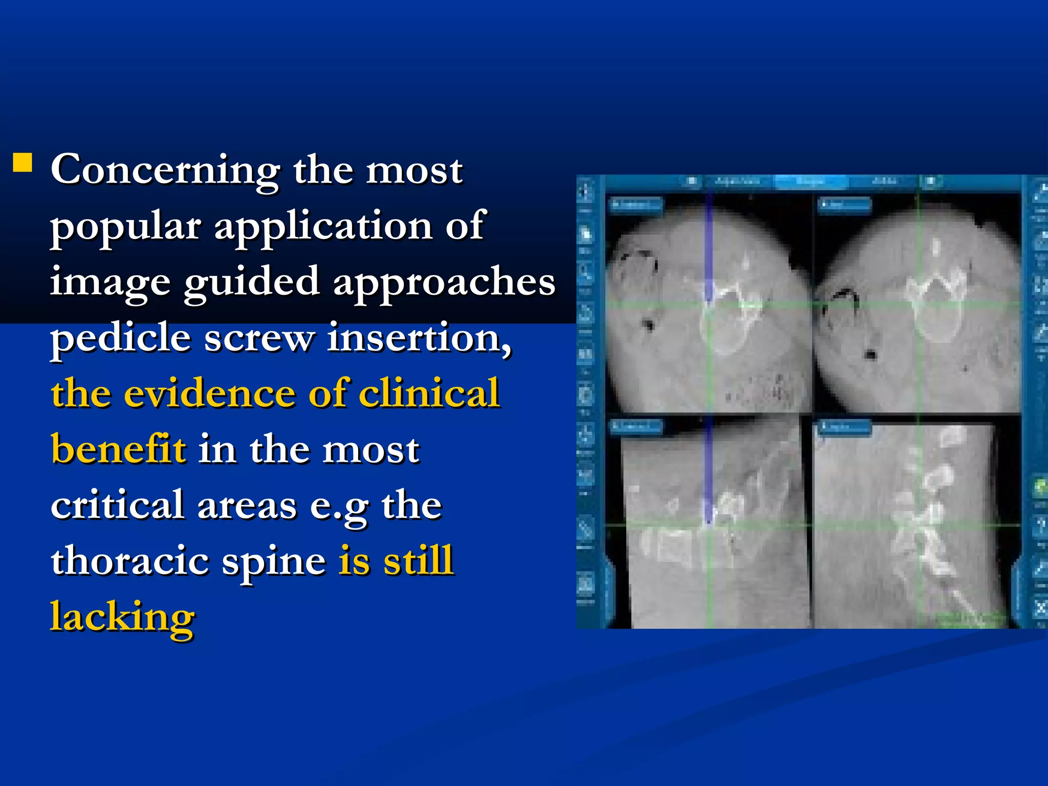  Concerning the mostConcerning the most
popular application ofpopular application of
image guided approachesimage guided approaches
pedicle screw insertion,pedicle screw insertion,
the evidence of clinicalthe evidence of clinical
benefitbenefit in the mostin the most
critical areas e.g thecritical areas e.g the
thoracic spinethoracic spine is stillis still
lackinglacking
 