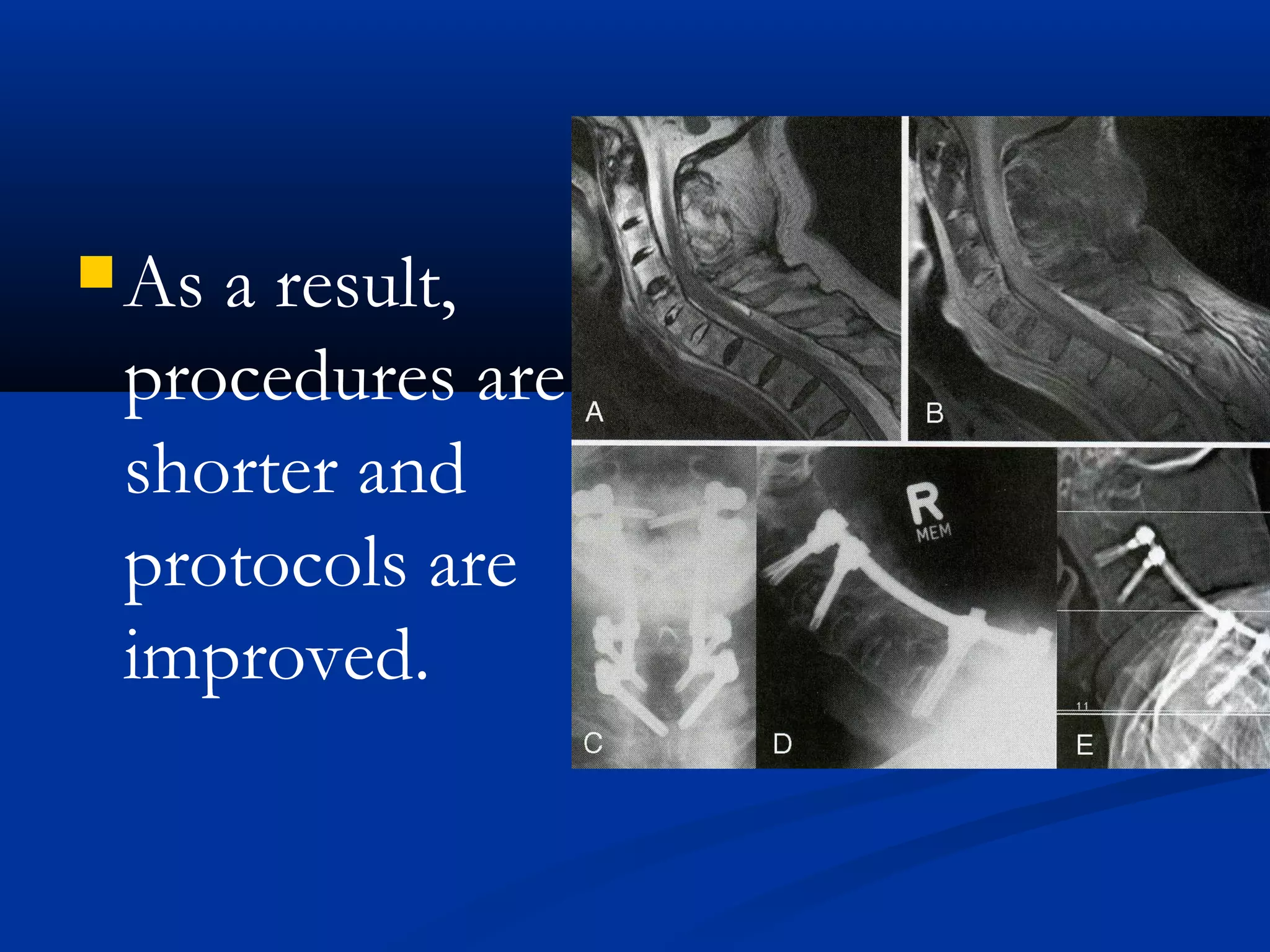 As a result,
procedures are
shorter and
protocols are
improved.
 