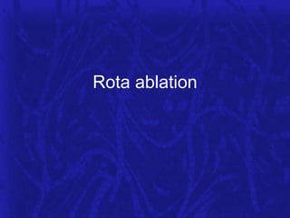 Rota ablation

 