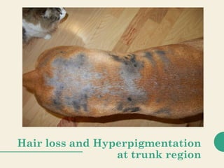 Hair loss and Hyperpigmentation
at trunk region
 