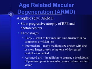 ARMD with basic retinal anatomy and management of armd | PPTX
