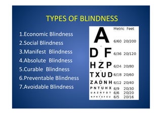 TYPES OF BLINDNESS
1.Economic Blindness
2.Social Blindness
3.Manifest Blindness
4.Absolute Blindness
5.Curable Blindness
6.Preventable Blindness
7.Avoidable Blindness
 