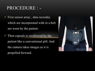  First sensor array , data recorder,
which are incorporated with in a belt
are worn by the patient.
 Then capsule is swallowed by the
patient like a conventional pill. And
the camera takes images as it is
propelled forward.
PROCEDURE : -
 