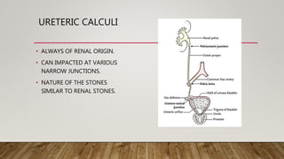 URETERIC CALCULI
• ALWAYS OF RENAL ORIGIN.
• CAN IMPACTED AT VARIOUS
NARROW JUNCTIONS.
• NATURE OF THE STONES
SIMILAR TO RENAL STONES.
 