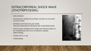 EXTRACORPOREAL SHOCK WAVE
LITHOTRIPSY(ESWL)
• NON-INVASIVE
• SHOCKWAVES GENERATED OUTSIDE THE BODY & FOCUSSED
ON THE STONES
• DIFFERENT METHODS INCLUDE SPARK
GAP,ELECTROMAGNETIC,PIEZOELECTRIC & MICROEXPULSIVE
• SHOCK WAVES GENERATED BY SPARK-GAP METHOD NEED TO
BE COORDINATED WITH ECG TO PREVENT CARDIAC
ARRHYTHMIAS.
• STONES UPTO 1.5 CM
• STEINSTRASSE
 