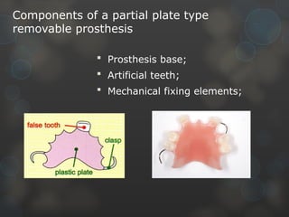 Comprehensive Guide to Partial Plate Type Removable Prosthesis ...