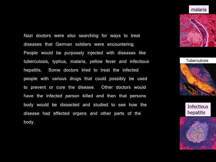 Nazi Experimentation And Treatment Of Twins Slide 15